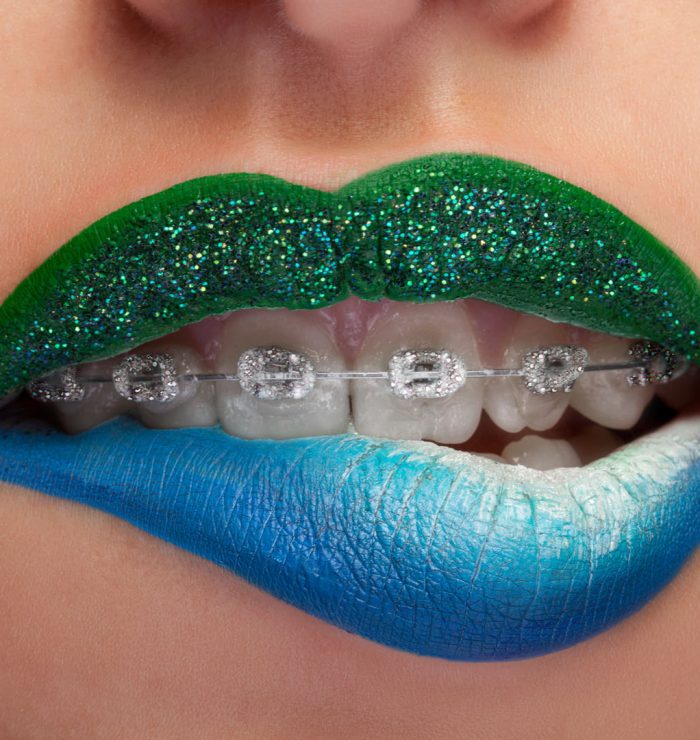 Close up mouth blue and green lips with glitter brackets