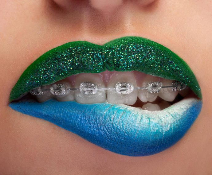 Close up mouth blue and green lips with glitter brackets